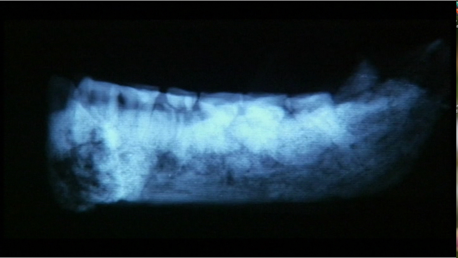 BBC Horizon LB6 Homo floresiensis x-ray